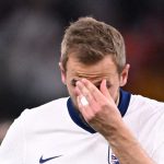 友谊赛 有伤在身